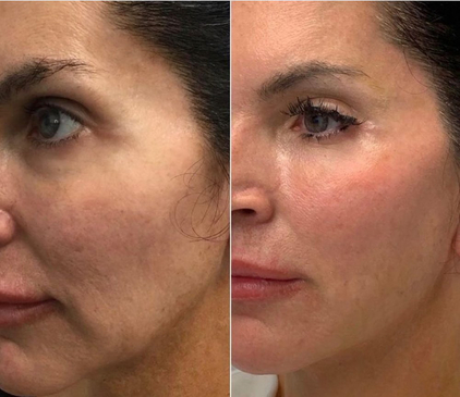 Slider image (3) Dr. Munoz Paris